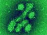  Is 2009A/H1N1 Outbreak A Herald Wave?




 
