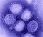   25% of H1N1 U.S. Patients Sick Enough To Be Hospitalized End Up in ICU




 
